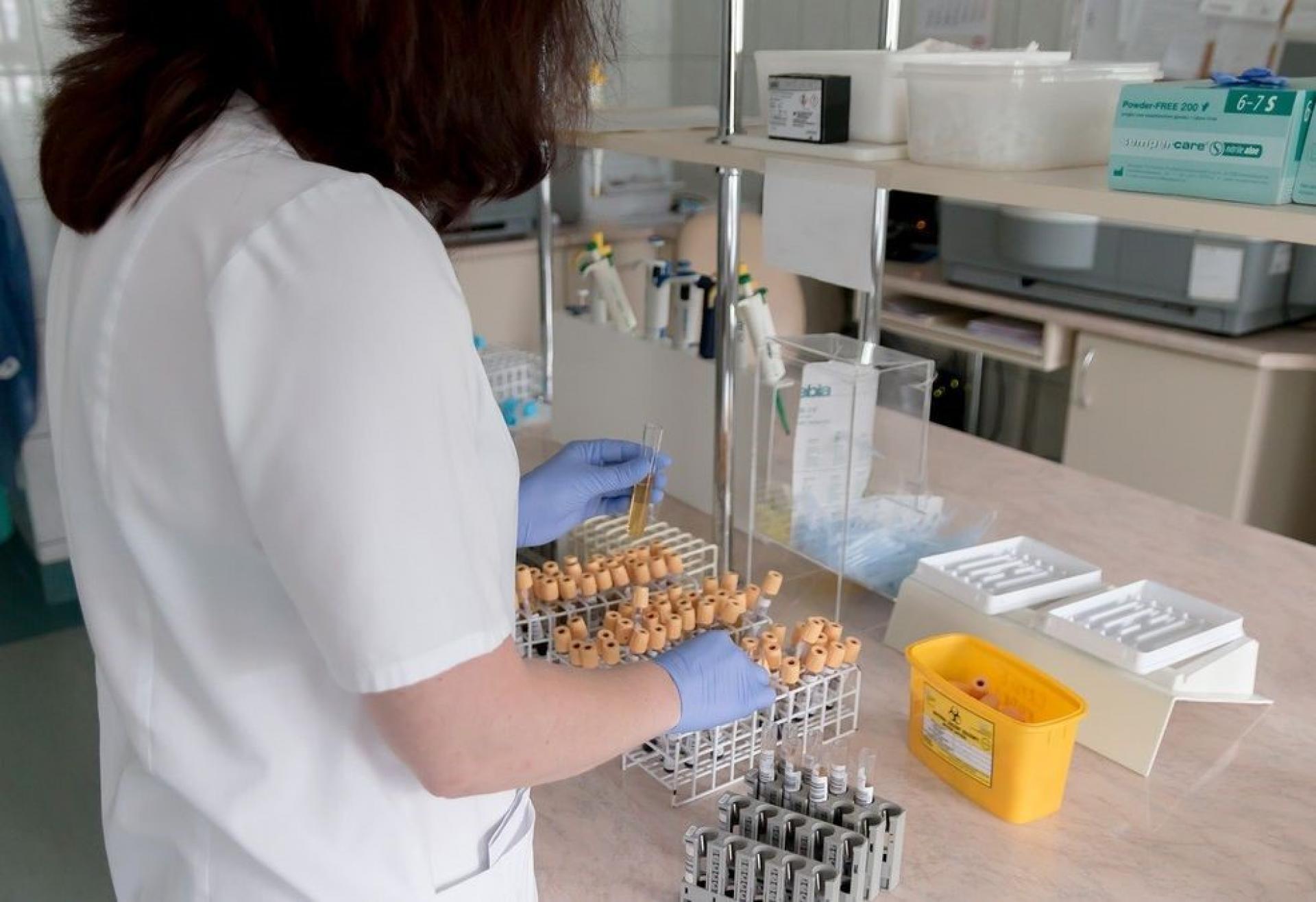 Dofinansowanie badań nad testem immunodiagnostycznym COVID - 19 dla UAM w partnerstwie ze Szpitalem w Wolicy - zobacz więcej